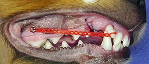 ortho dentisty procedure